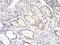 SMAD Family Member 4 antibody, NBP1-51646, Novus Biologicals, Immunohistochemistry frozen image 