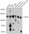 Collagen Type VI Alpha 1 Chain antibody, A02226-2, Boster Biological Technology, Western Blot image 