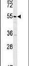 TSPY Like 4 antibody, PA5-25726, Invitrogen Antibodies, Western Blot image 