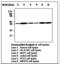 Cyclin Dependent Kinase 4 antibody, LS-C62159, Lifespan Biosciences, Western Blot image 