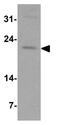 Interleukin 9 antibody, GTX31894, GeneTex, Western Blot image 