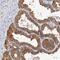 Ribonuclease A Family Member 11 (Inactive) antibody, NBP1-88423, Novus Biologicals, Immunohistochemistry frozen image 
