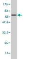 Carboxypeptidase B1 antibody, H00001360-M01, Novus Biologicals, Western Blot image 