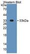 Dicer 1, Ribonuclease III antibody, abx130950, Abbexa, Western Blot image 