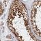 Katanin Catalytic Subunit A1 antibody, NBP1-89491, Novus Biologicals, Immunohistochemistry frozen image 