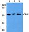 Cathepsin F antibody, A06600, Boster Biological Technology, Western Blot image 