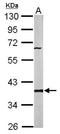 Protein Phosphatase 2 Catalytic Subunit Beta antibody, NBP1-32069, Novus Biologicals, Immunohistochemistry paraffin image 