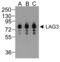 Lymphocyte Activating 3 antibody, RF16089, ProSci, Western Blot image 