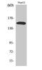 Phospholipase C Gamma 2 antibody, STJ90768, St John