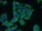 Latent Transforming Growth Factor Beta Binding Protein 1 antibody, 26855-1-AP, Proteintech Group, Immunofluorescence image 