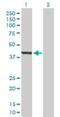 Ankyrin Repeat, SAM And Basic Leucine Zipper Domain Containing 1 antibody, H00136991-B01P, Novus Biologicals, Western Blot image 