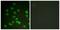 DEAD-Box Helicase 3 X-Linked antibody, LS-C198876, Lifespan Biosciences, Immunofluorescence image 
