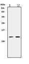 Prokineticin 1 antibody, PB9882, Boster Biological Technology, Western Blot image 
