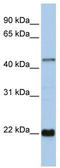 Zinc Finger Protein 581 antibody, TA339490, Origene, Western Blot image 