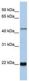 Zinc Finger Protein 581 antibody, TA339490, Origene, Western Blot image 