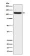 O-Linked N-Acetylglucosamine (GlcNAc) Transferase antibody, M00474, Boster Biological Technology, Western Blot image 