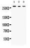 Talin 2 antibody, PA5-80134, Invitrogen Antibodies, Western Blot image 