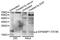 Eukaryotic Translation Initiation Factor 4E Binding Protein 1 antibody, AP0030, ABclonal Technology, Western Blot image 
