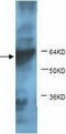 Kruppel Like Factor 15 antibody, TA310150, Origene, Western Blot image 