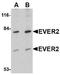 Transmembrane Channel Like 8 antibody, NBP1-76903, Novus Biologicals, Western Blot image 