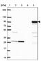 Sarcosine Dehydrogenase antibody, PA5-63423, Invitrogen Antibodies, Western Blot image 