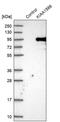 KIAA1586 antibody, PA5-57630, Invitrogen Antibodies, Western Blot image 