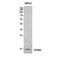 Interferon Induced Transmembrane Protein 2 antibody, A04964, Boster Biological Technology, Western Blot image 