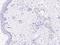 Plasmalemma Vesicle Associated Protein antibody, 200825-T08, Sino Biological, Immunohistochemistry frozen image 