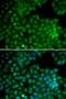 Cyclin Dependent Kinase 7 antibody, LS-C748009, Lifespan Biosciences, Immunofluorescence image 