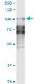 Desmocollin 2 antibody, H00001824-M14, Novus Biologicals, Western Blot image 
