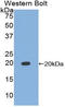 TIMP Metallopeptidase Inhibitor 1 antibody, LS-C296666, Lifespan Biosciences, Western Blot image 