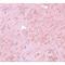 Protein Inhibitor Of Activated STAT 4 antibody, LS-C108719, Lifespan Biosciences, Immunohistochemistry frozen image 