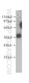 Chaperonin Containing TCP1 Subunit 6B antibody, 12628-1-AP, Proteintech Group, Western Blot image 