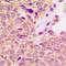 Insulin Receptor Substrate 1 antibody, orb315570, Biorbyt, Immunohistochemistry paraffin image 