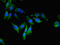 Eukaryotic Elongation Factor 2 Kinase antibody, LS-C396342, Lifespan Biosciences, Immunofluorescence image 