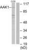 AP2 Associated Kinase 1 antibody, abx013644, Abbexa, Western Blot image 