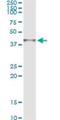 Arginase 2 antibody, H00000384-M05, Novus Biologicals, Immunoprecipitation image 