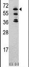 ACK1 antibody, PA5-14766, Invitrogen Antibodies, Western Blot image 