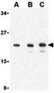 Amino-terminal enhancer of split antibody, GTX16982, GeneTex, Western Blot image 