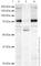 Synaptic Vesicle Glycoprotein 2A antibody, ab32942, Abcam, Western Blot image 