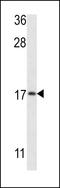 Microtubule Associated Protein 1 Light Chain 3 Beta antibody, LS-C156410, Lifespan Biosciences, Western Blot image 