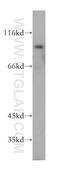 Slingshot Protein Phosphatase 3 antibody, 18324-1-AP, Proteintech Group, Western Blot image 