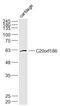 BPI Fold Containing Family B Member 4 antibody, GTX51455, GeneTex, Western Blot image 