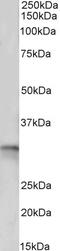 Tyrosyl-DNA Phosphodiesterase 1 antibody, 43-543, ProSci, Western Blot image 