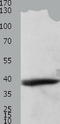 Tropomyosin 2 antibody, TA321953, Origene, Western Blot image 