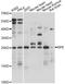 Ribulose-5-Phosphate-3-Epimerase antibody, A14778, ABclonal Technology, Western Blot image 