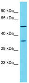 Nuclear Receptor Subfamily 1 Group H Member 2 antibody, TA332017, Origene, Western Blot image 