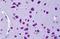 CYLD Lysine 63 Deubiquitinase antibody, orb19453, Biorbyt, Immunohistochemistry paraffin image 