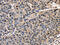 Alpha Fetoprotein antibody, CSB-PA251527, Cusabio, Immunohistochemistry paraffin image 