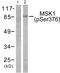 Ribosomal Protein S6 Kinase A5 antibody, PA5-38141, Invitrogen Antibodies, Western Blot image 